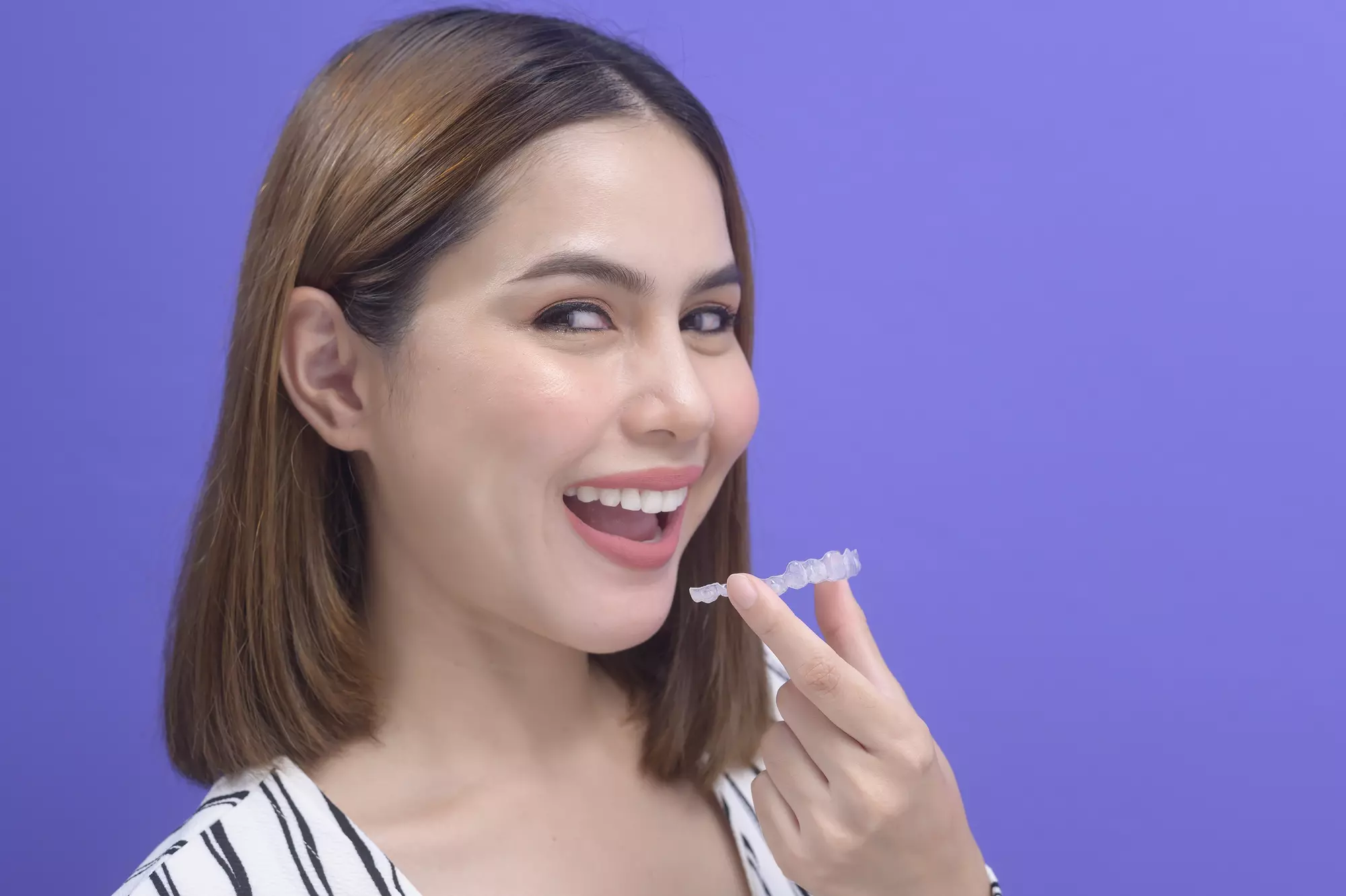 Jenis Behel Gigi